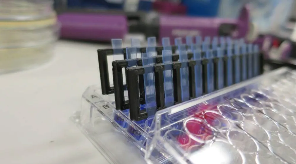 الاختبار الجديد يحدد العلاج الدقيق لالتهاب المسالك البولية خلال ساعات (جامعة ريدينغ)