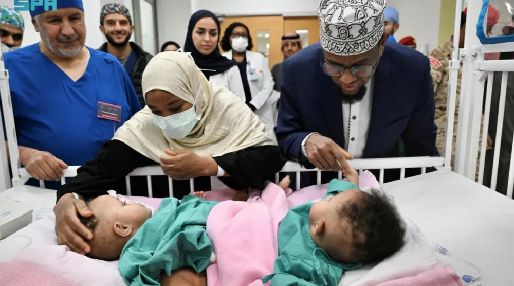 التوأم الملتصق الصومالي «رحمة ورملا» قبل العملية (واس)