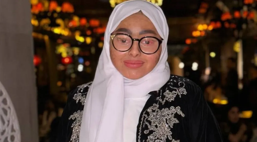 لم يقف مرض السمكيّة في وجه تحقيق دانية الصبّان حلم الغناء (صور الصبّان)