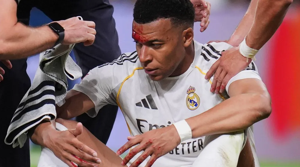 مبابي أظهر حجم جرحه أمام 131 مليون متابع له على «إنستغرام» (أ.ب)