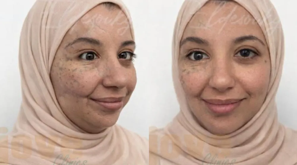 صورتان لآية سلامة بعد عمليات التجميل في مصر (الطبيب المعالج)