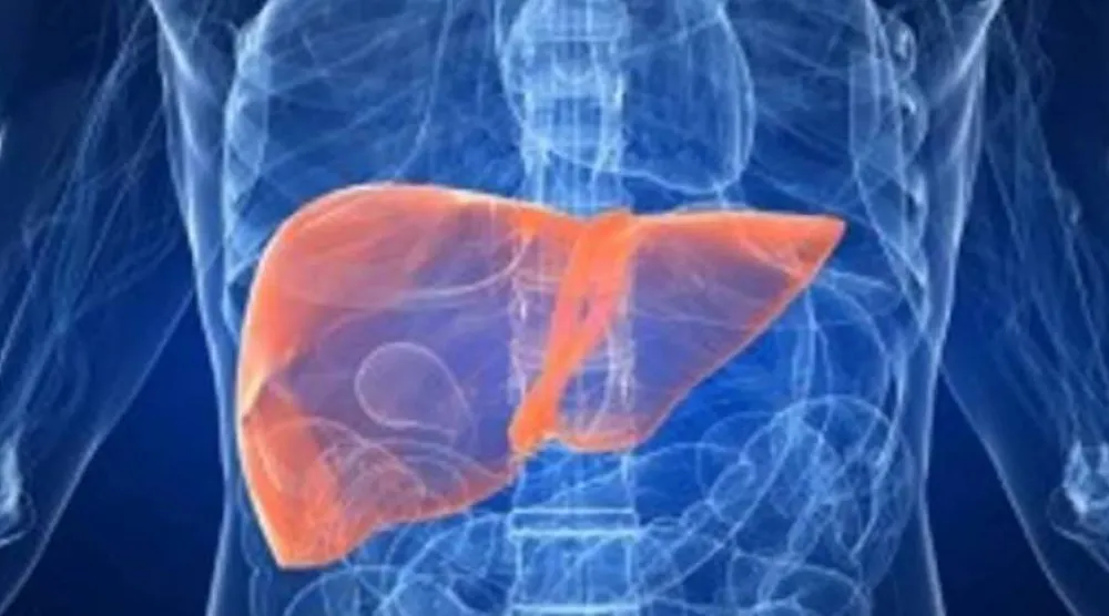 يُعدّ مرض الكبد الدهني المرتبط باضطرابات الأيض من أكثر الأمراض انتشاراً (رويترز)