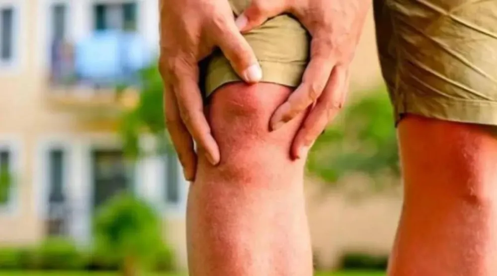 تزيد الدهون المتراكمة في عضلات الفخذ من خطر الإصابة بهشاشة العظام في الركبة (رويترز)