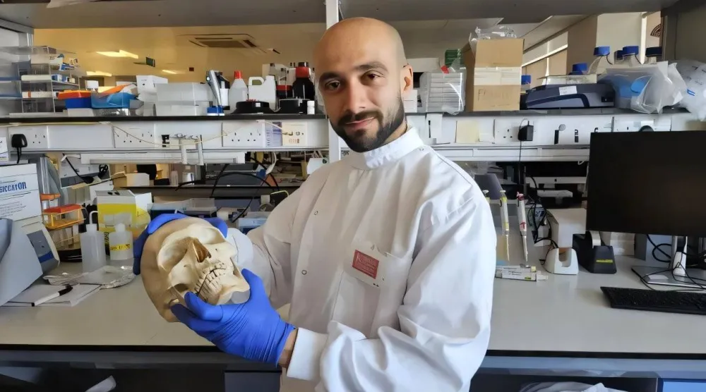 الدكتور شريف الشرقاوي الباحث الرئيسي للدراسة بجامعة كينجز كوليدج لندن يحمل مجسماً لجمجمة بشرية (جامعة كينجز كوليدج لندن)