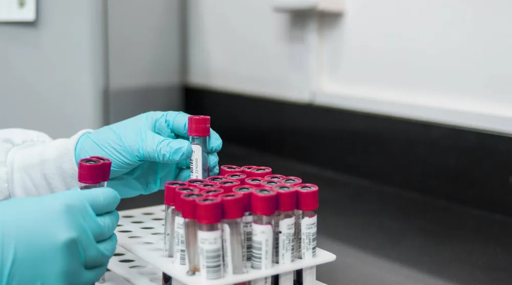 عينات دم لفحص مستوى الكوليسترول في الجسم (بيكساباي)