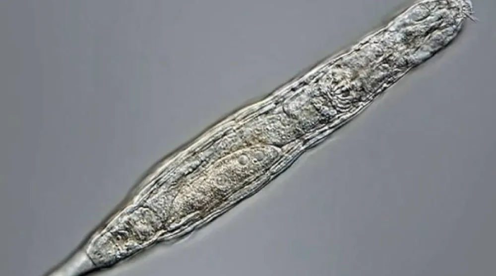 «دودة الزومبي» حيوان مجهري متعدد الخلايا (أرشيفية - أ.ف.ب)