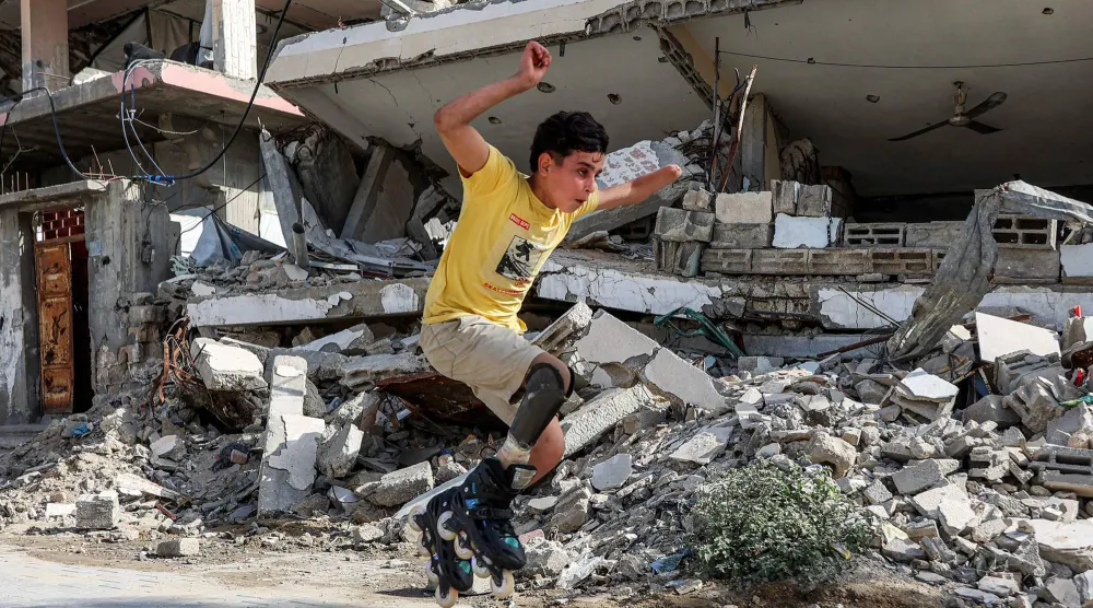 فتى فلسطيني يقفز بعدما تم تركيب «وصلة ساق اصطناعية» له يقفز في أحد شوارع مدينة غزة الأربعاء (أ.ف.ب)