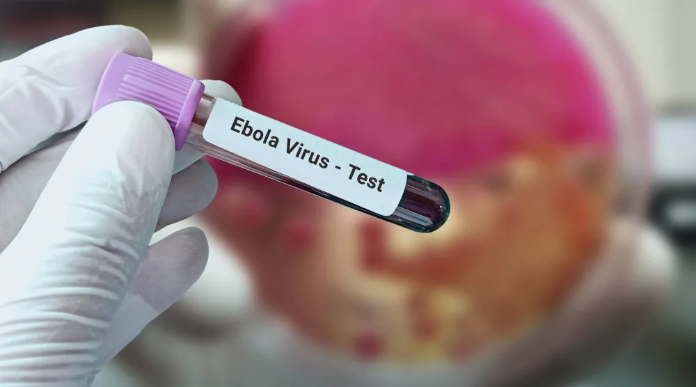 أنبوبة لاختبار فيروس «إيبولا»