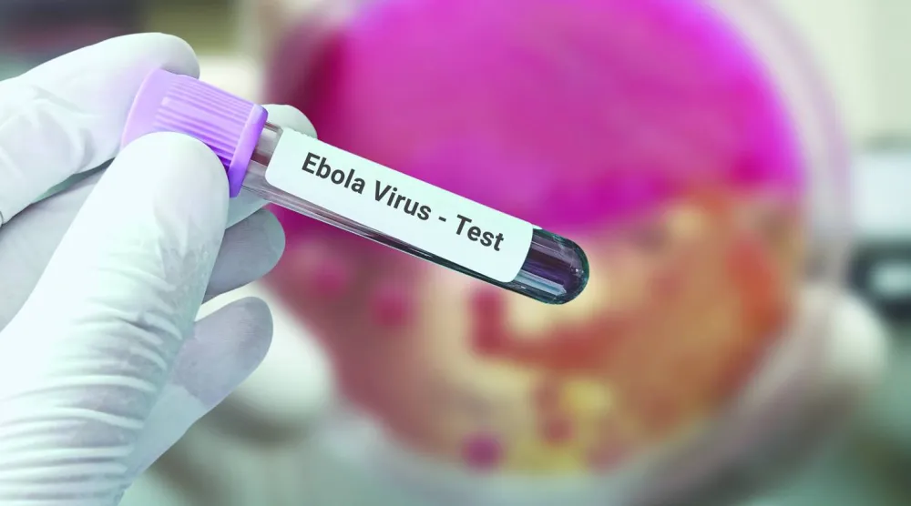 
أنبوبة لاختبار فيروس «إيبولا«