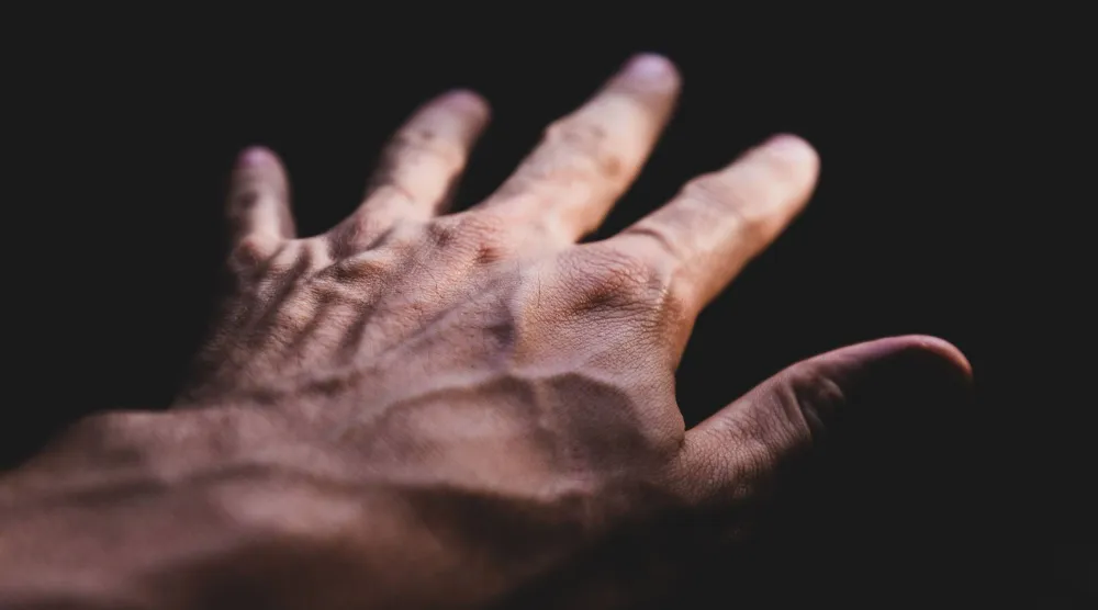 ترقق الجلد يُعد أحد أبرز الأسباب التي تؤدي إلى بروز الأوردة (بيكسلز)