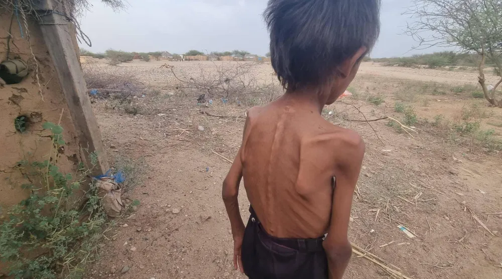 مع تسجيل جيوب للمجاعة يحتاج نصف سكان اليمن إلى المساعدات (إعلام محلي)