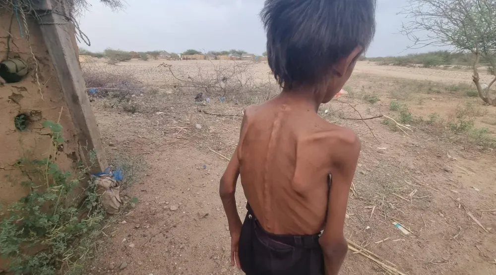Yemen'de bazı bölgelerde kıtlık vakaları kaydedilirken, nüfusun yarısının yardıma ihtiyacı var, (Yerel medya)