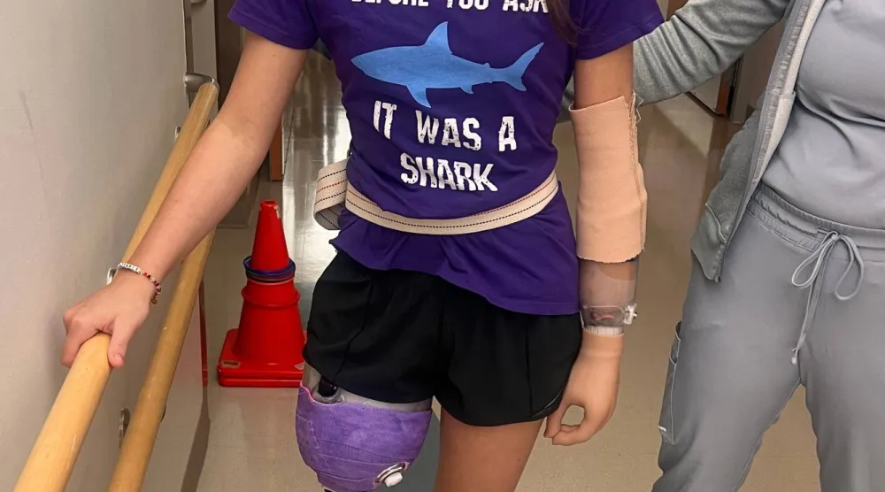 This undated photo courtesy of the Gribbin family shows Lulu Gribbin, who lost her hand and part of her leg in a shark attack off the coast of Florida in 2024. (Courtesy of Gribbin family)