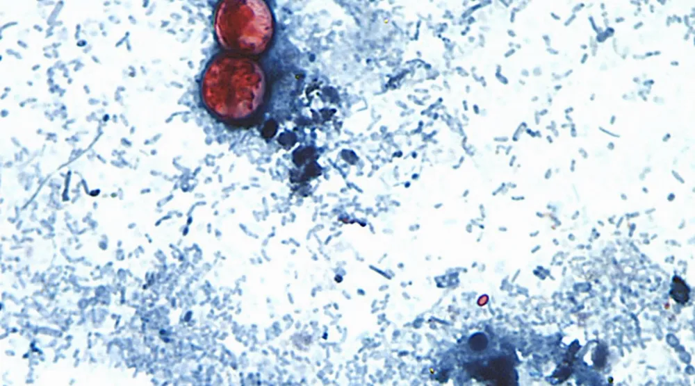 صورة مجهرية من مركز السيطرة على الأمراض (CDC) تُظهر طفيليات «السيكلوسبورا» في عينة براز مصبوغة بالسافرانين (أسوشيتد برس)
