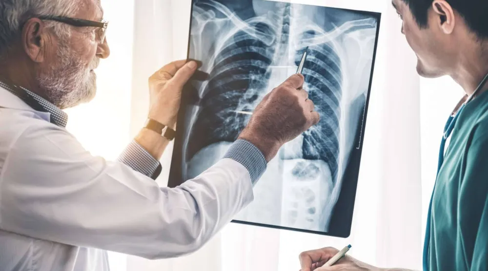 سرطان الرئة من أكثر أنواع السرطان فتكاً في العالم (جامعة فلوريدا)