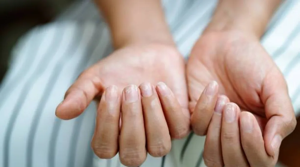 يعد البروتين من العناصر الأساسية لصحة الجلد والأظافر (بيكسلز)