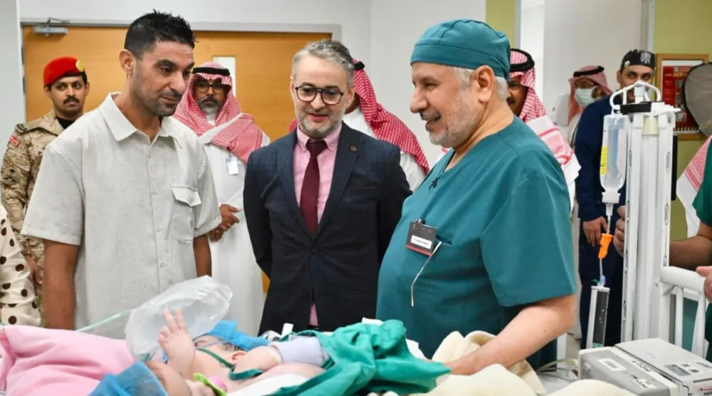 الدكتور عبد الله الربيعة يطمئن على التوأم الملتصق المغربي «سجى وضحى» قبل بدء العملية (واس)
