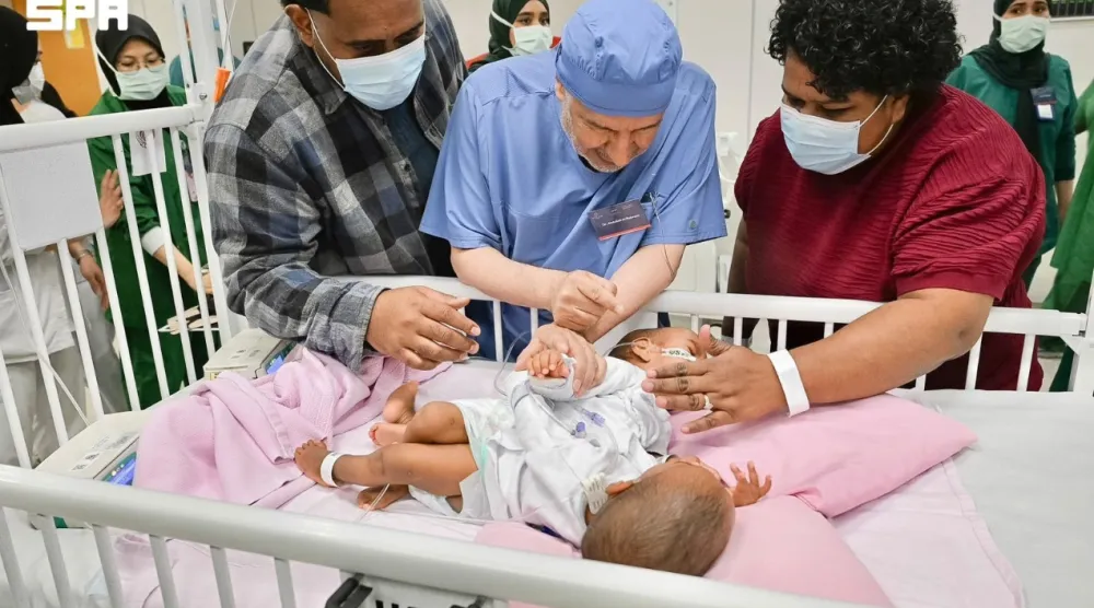 الدكتور عبد الله الربيعة يطمئن على التوأم الملتصق الفيجي «جسبيلي وديسيسيا» قبل بدء العملية (واس)