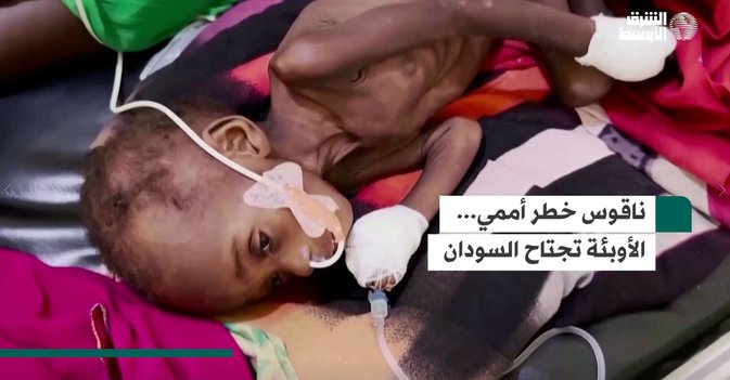 ناقوس خطر أممي... الأوبئة تجتاح السودان