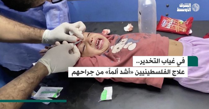 في غياب التخدير.. علاج الفلسطينيين «أشد ألماً» من جراحهم