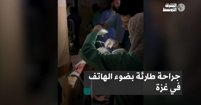 جراحة طارئة بضوء الهاتف في غزة