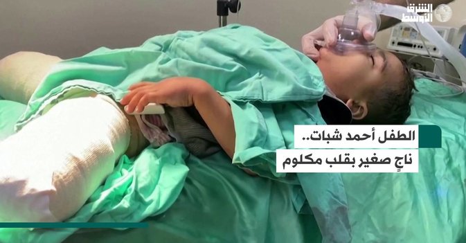 الطفل أحمد شبات.. ناجٍ صغير بقلب مكلوم