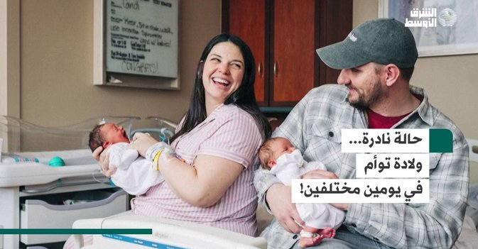 حالة نادرة... ولادة توأم في يومين مختلفين!