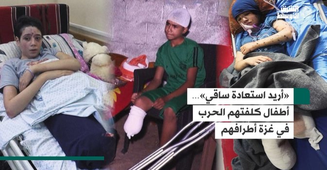«أريد استعادة ساقي»… أطفال كلفتهم الحرب في غزة أطرافهم