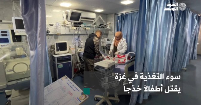 سوء التغذية في غزة يقتل أطفالاً خدّجاً