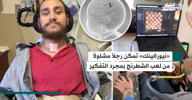 «نيورالينك» تمكن رجلاً مشلولاً من لعب الشطرنج بمجرد التفكير