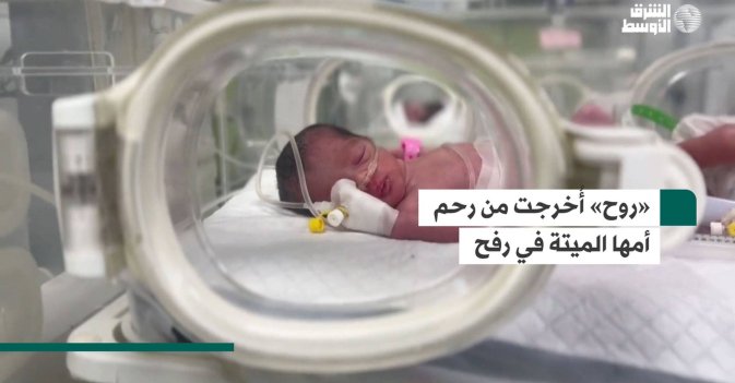 «روح» أُخرجت من رحم أمها الميتة في رفح