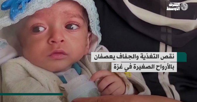 نقص التغذية والجفاف يعصفان بالأرواح الصغيرة في غزة
