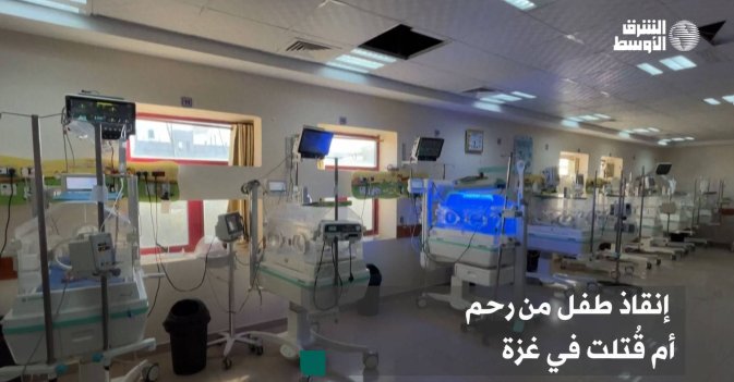 إنقاذ طفل من رحم أم قُتلت في غزة
