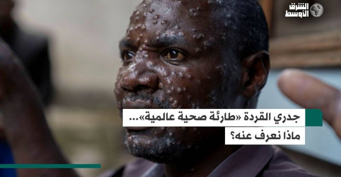 جدري القردة «طارئة صحية عالمية»... ماذا نعرف عنه؟