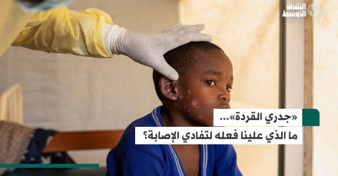 «جدري القردة»... ما الذي علينا فعله لتفادي الإصابة؟