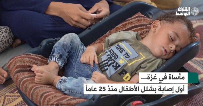 مأساة في غزة... أول إصابة بشلل الأطفال منذ 25 عاماً