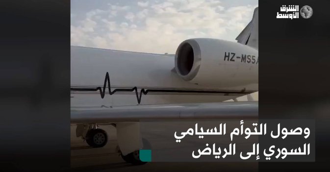 وصول التوأم السيامي السوري إلى الرياض