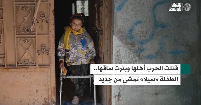 قتلت الحرب أهلها وبترت ساقها.. الطفلة «سيلا» تمشي من جديد