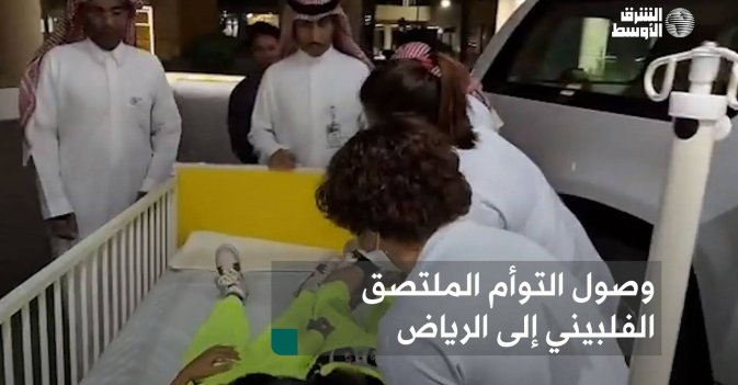 وصول التوأم الملتصق الفلبيني إلى الرياض