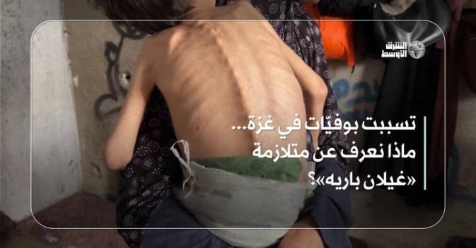 تسببت بوفيّات في غزة.. ماذا نعرف عن متلازمة «غيّان – باريه»؟