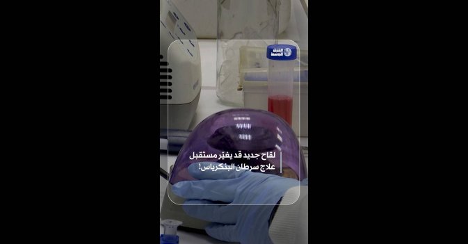 علاج جديد قد يغٌير متقبل علاج سرطان البنكرياس