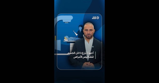 أجهزة تزرع داخل الجسم لتشخيص الأمراض