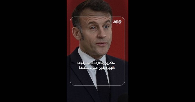 ماكرون بنظارات شمسية بعد ظهوره بعين حمراء منتفخة