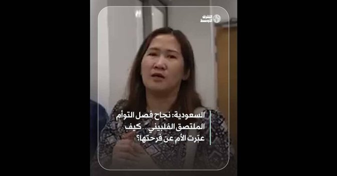 السعودية: نجاح فصل التوأم الملتصق الفلبيني… كيف عبّرت الأم عن فرحتها؟