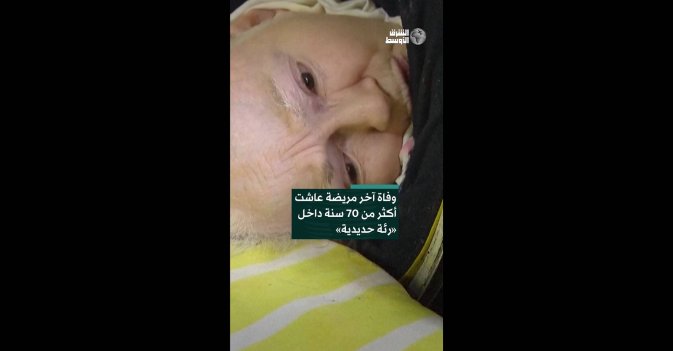وفاة آخر مريضة عاشت أكثر من 70 سنة داخل «رئة حديدية»22