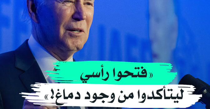 «فتحوا رأسي ليتأكدوا من وجود دماغ!»