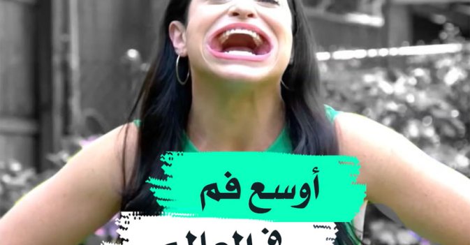 أوسع فم في العالم