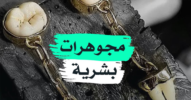 مجوهرات بشرية