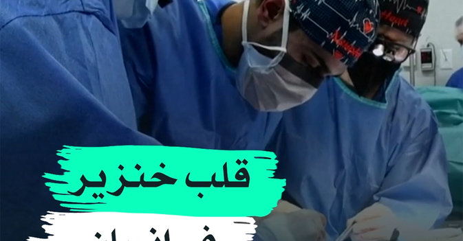 قلب خنزير في إنسان