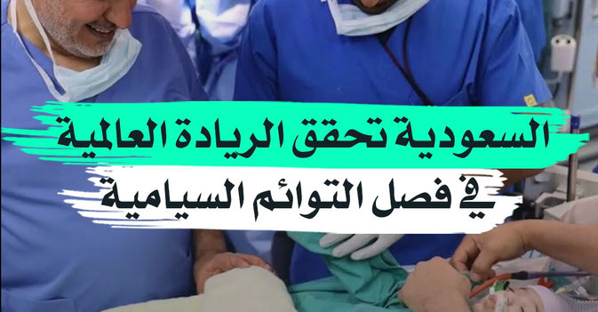 السعودية تحقق الريادة العالمية في فصل التوائم السيامية